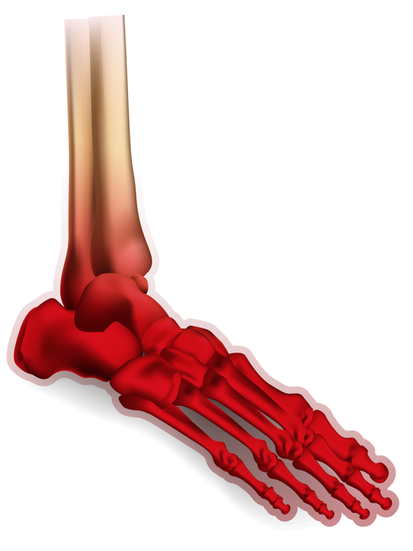 Ankle Diagrams Trauma