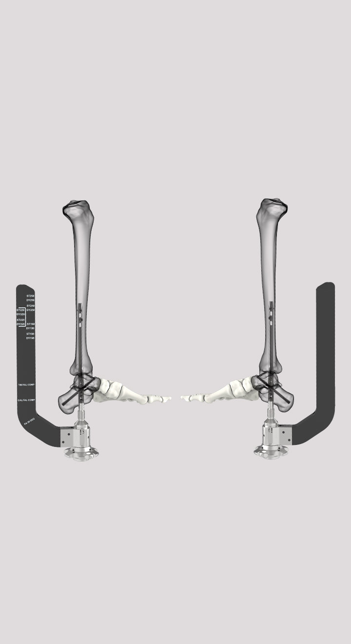 PA Fixation Image 720X1320 V2