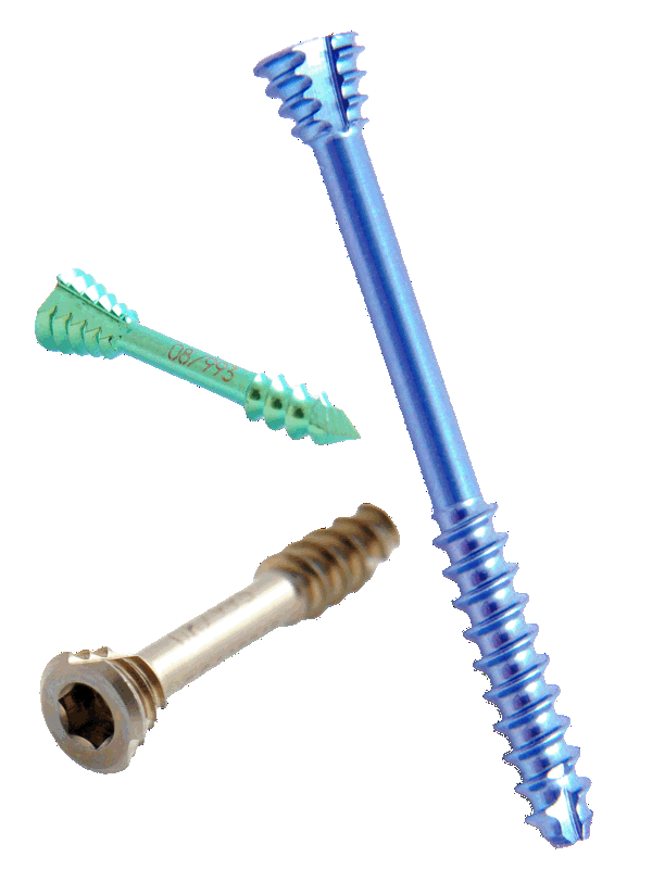OS Product Header Hero Foot Osteotomy