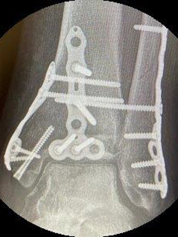 Focus Circle 300X300 (1)