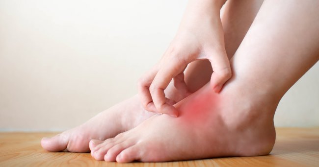 Charcot midfoot reconstruction—surgical technique based on  deformity patterns