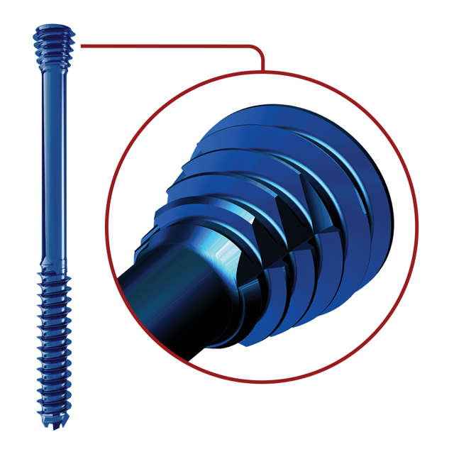 Conical Neck & Forward Cutting Flutes