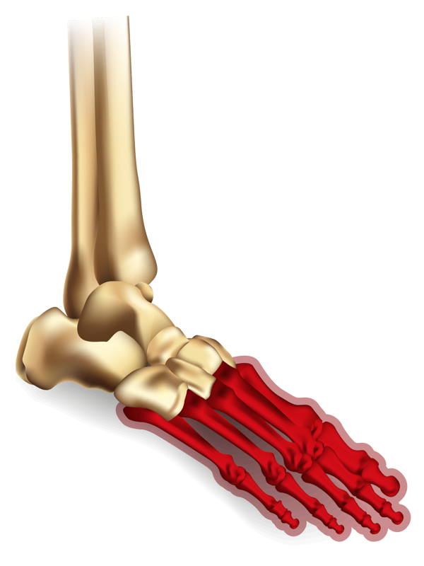 Ankle Diagrams Forefoot