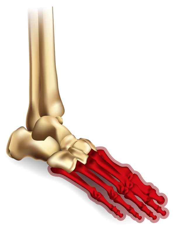 Ankle Diagrams Forefoot
