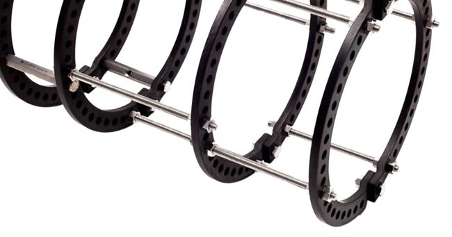 Ring Fixator System (RFS)