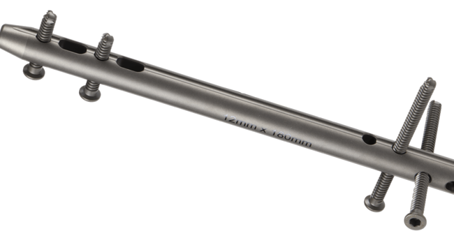 Oxbridge™  Ankle Fusion Nail