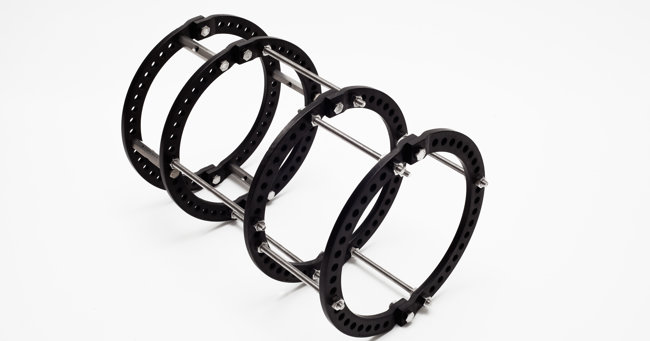 Ring Fixator System – RFS™
