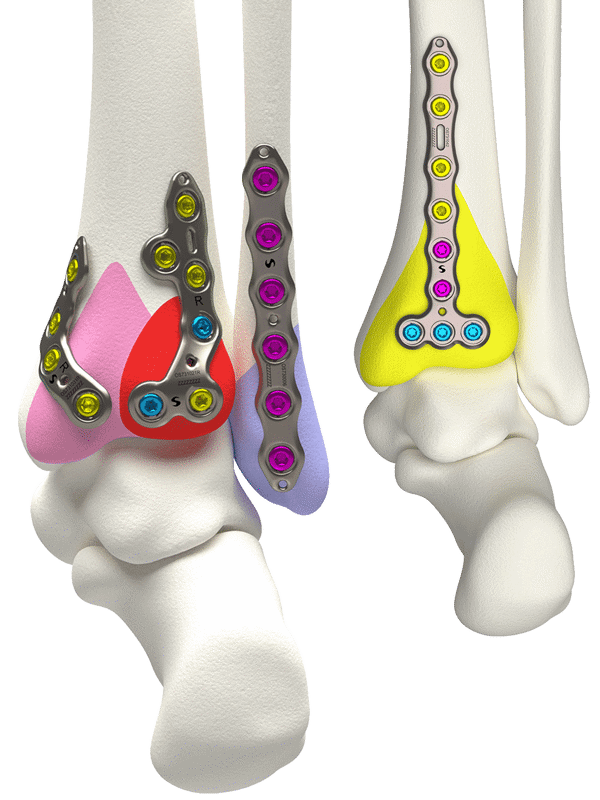 OS Product Header Hero Volition Ankle (1)