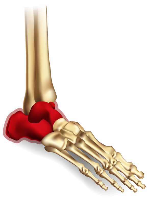 Ankle Diagrams Hindfoot