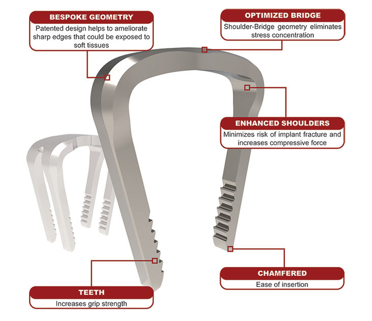 Staple Attributes Rev03