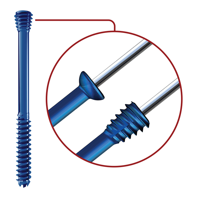Headed and Headless Screw Options