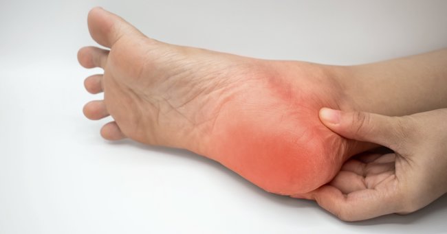 Charcot Foot Reconstruction: Hardware failure and non-union affect the clinical outcomes