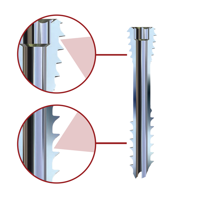 Opposing Flank Angles