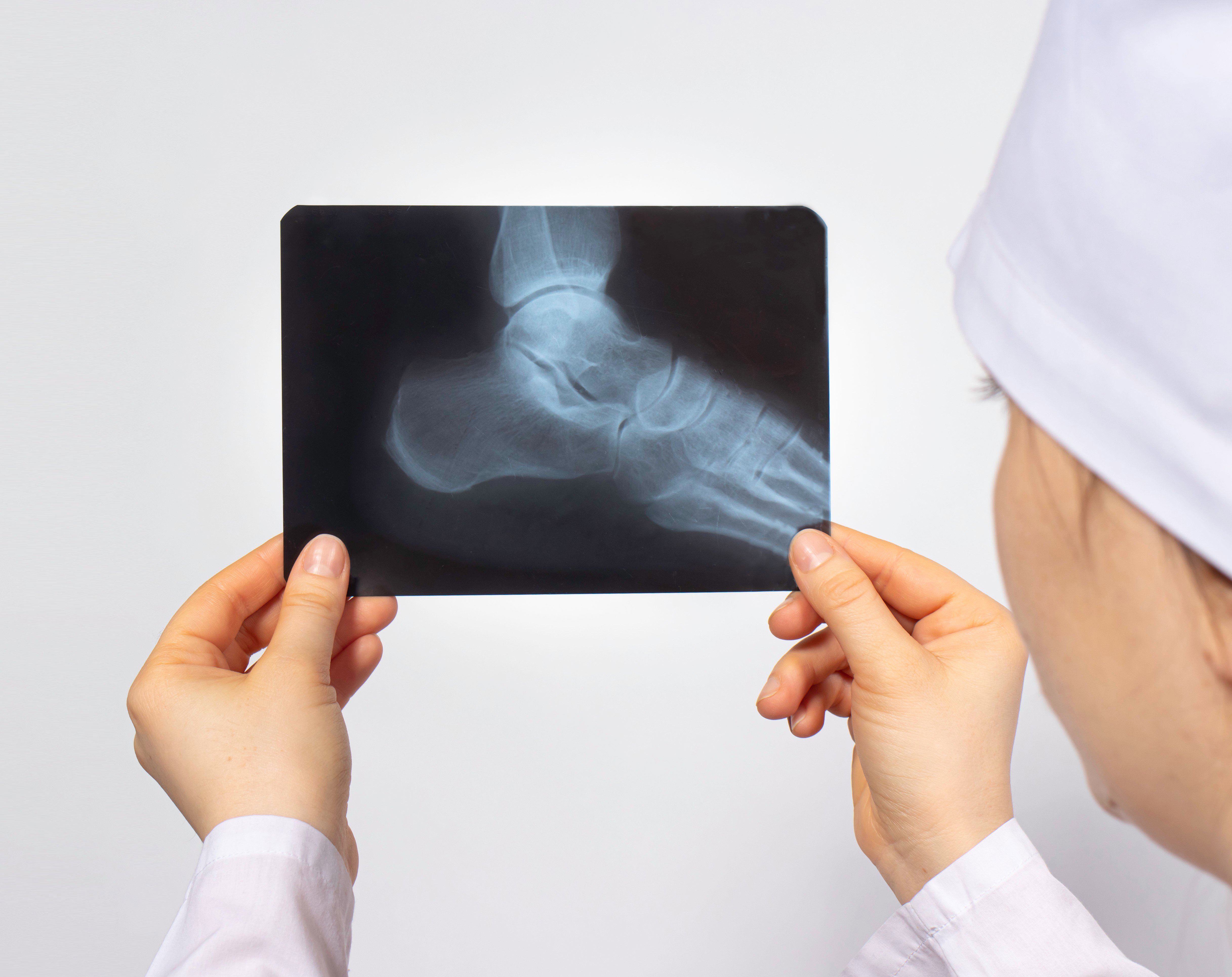 Surgeon holding foot x-ray home hero 3