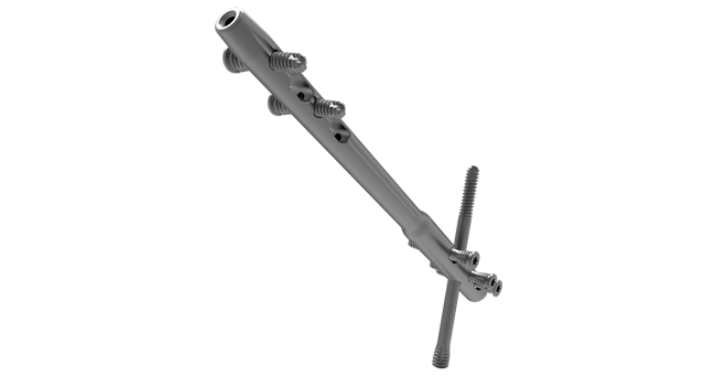 SUCCESSION® TTC Nail System Surgical Technique