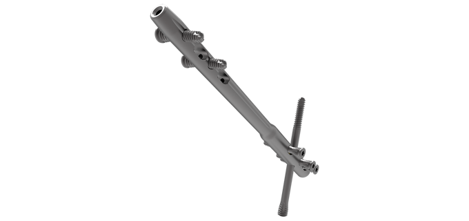 SUCCESSION® TTC Nail System